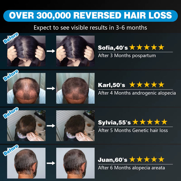 120 Diodes Hair Growth Cap 850Nm 660Nm Red Light Therapy Cap for Hair Regrowth anti Hair Loss Relax Scalp Hair Care Hat